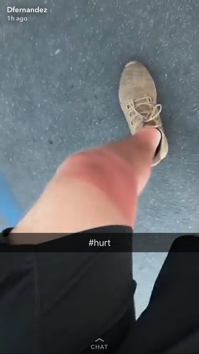 natehern15's tweet photo. Someone save my boy @djtfernandez with that Aloe Veraππhe wasn't ready https://t.co/ey8zyRSCiw