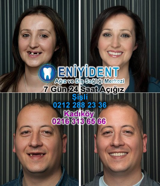 Diş Teli Fiyatları En Uygun Ve ... ve #DişTeliFiyatları2017 #DişTeliFiyatlarıSsk tüm bilgiler için tıklayınız uzmandisdoktoru.net/dis-teli-fiyat…