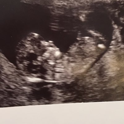 spurs_sel's tweet photo. #NewProfilePic #bubbayid #bubbayidette #takingbets https://t.co/VGiJrzQ2EC