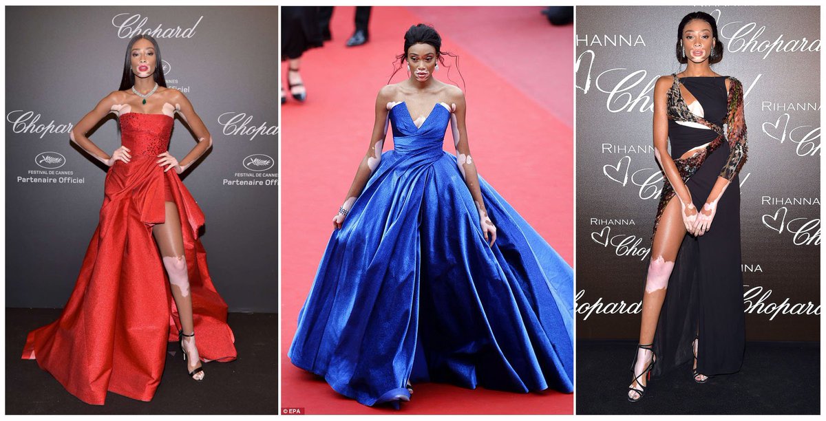 All three looks of <a href="/winnieharlow/">♔Winnie Harlow♔</a> #styled by our girls <a href="/styling_duo/">Radcliffe & Sciamma</a> for #Cannes2017 #CannesFilmFestival #winnieharlow #radcliffeandscciamma