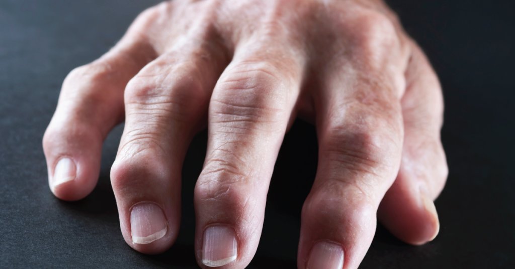 WebMD's tweet photo. Smoking doesn't just ravage your lungs -- it also takes its toll on these surprising body parts: https://t.co/RP82XOFRG7 https://t.co/RWICQsVeau