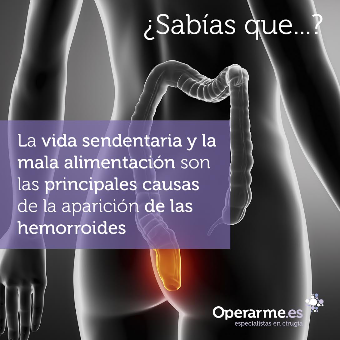 Operarme's tweet photo. #Hemorroides #EspacialistasCirugía https://t.co/0EwJAssEE9