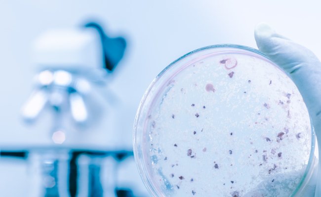 GutMicrobiotaWW's tweet photo. "What's your gut microbiome enterotype?" via @Care2 by @nutrition_facts https://t.co/3W6BkM6U1t #microbiota #enterotype https://t.co/QRxZZUDcHO