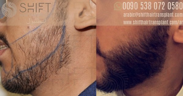 SHIFT Hair TR tweet media