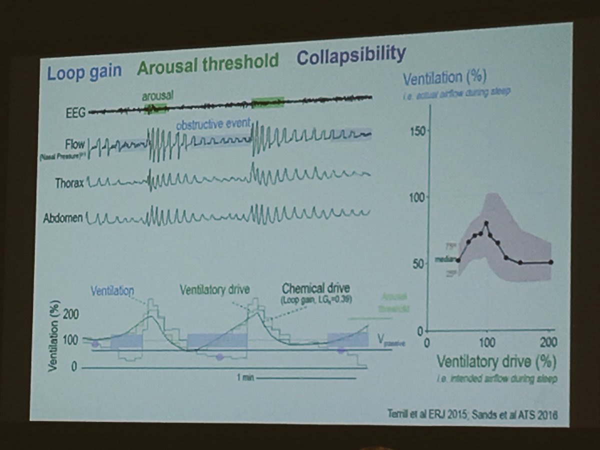 Dr. Scott Sands shows convincing evidence that we can measure OSA physiology from a standard PSG #personalisedmedicine