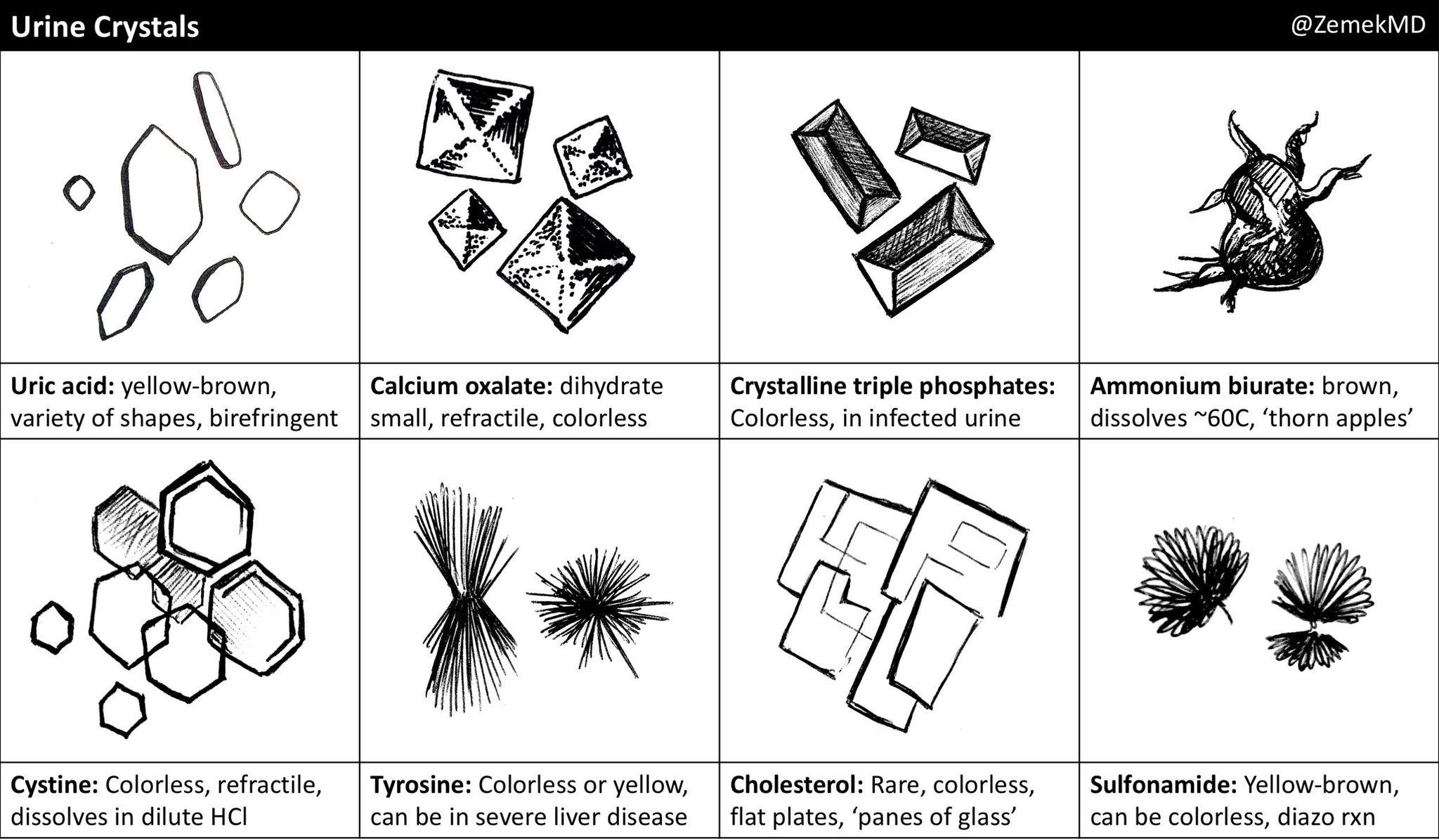 cholesterol-crystals-in-urine-sediment