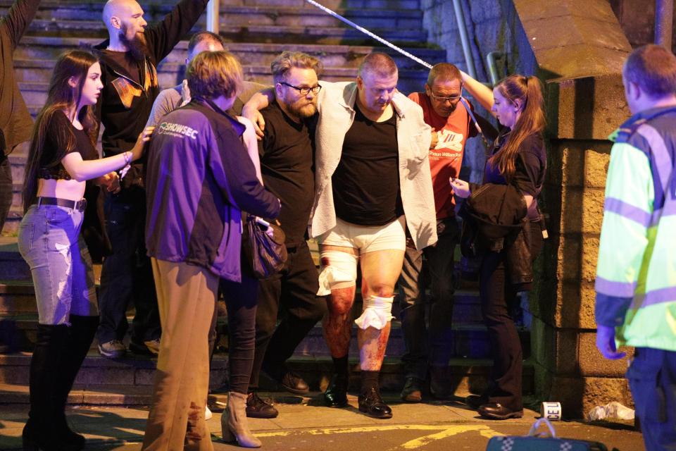 TheSun's tweet photo. An injured man is seen being led away from #ManchesterArena https://t.co/W5NRo0Vqdj https://t.co/GnMoJkMIMR