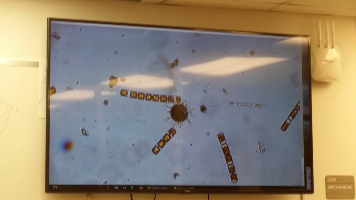 aquamarinevic's tweet photo. Just a few of the many zooplankton we don't even think are there in our ocean!  #measfieldcourse https://t.co/bwCpRcFM6a