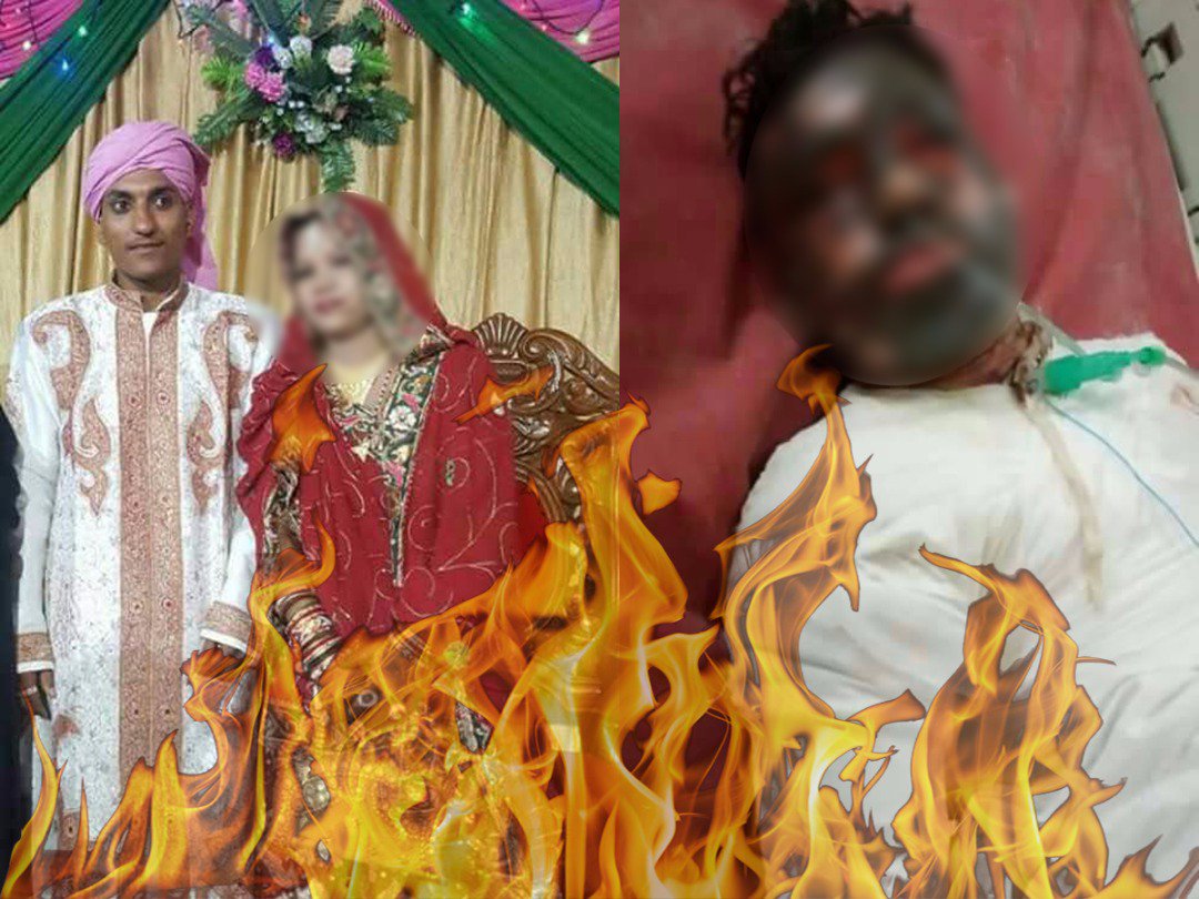 amitdeshmra's tweet photo. #Justice4ImranKhan Any hope for justice? He purportedly self immolated while under attack by in laws. Confessed in PS w 80% burns #RIPImran https://t.co/GSSi9C309t