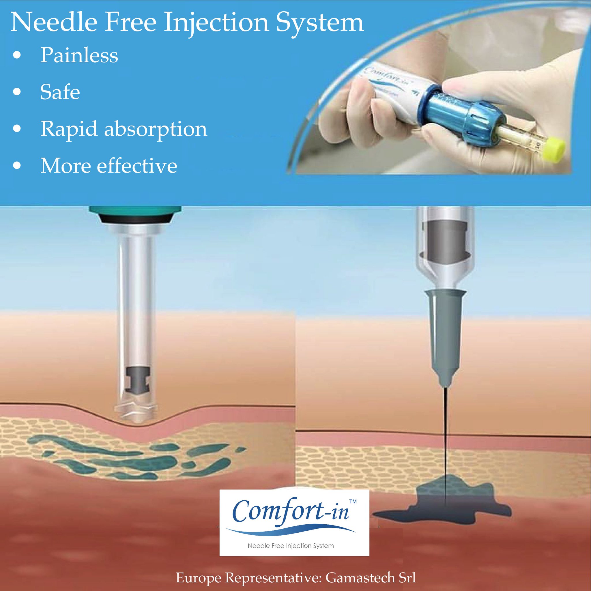 Comfort-in on X: Comfort-in, the most Advanced Infusion System.   #NeedleFree #painFree #Comfortin #safe #timesaving  #moderndentist  / X