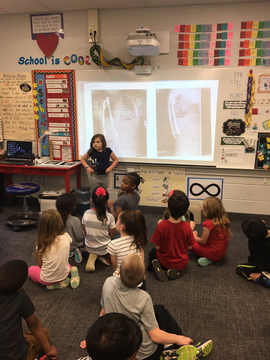 wahooz's tweet photo. @abbeesarmee showing her latest X-rays to #mhgkinderoz @GuestElementary @WalledLkSchools @MottChildren #miraclechild #kindergartenstrong https://t.co/WGlj9dVnzZ