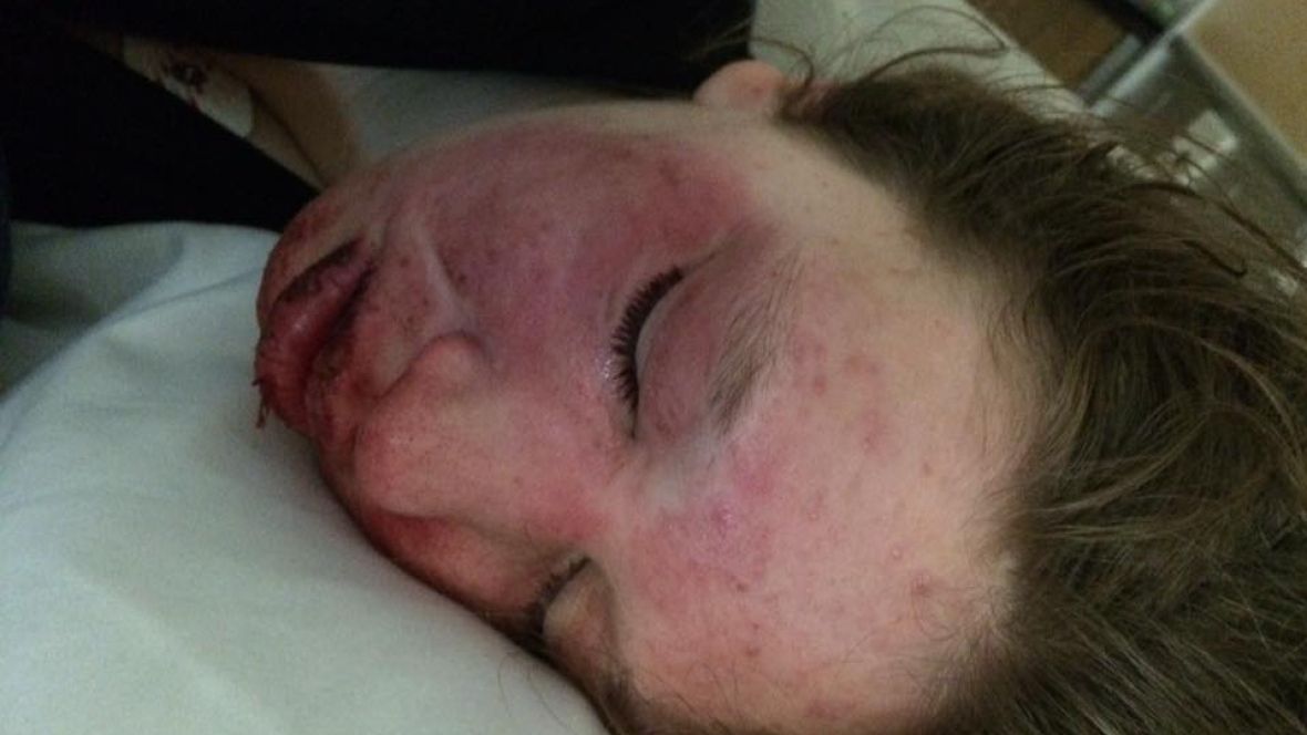 'Worst kind of helplessness': Ontario family struggles to find support for autistic, self-harming teen cbc.ca/1.4124127