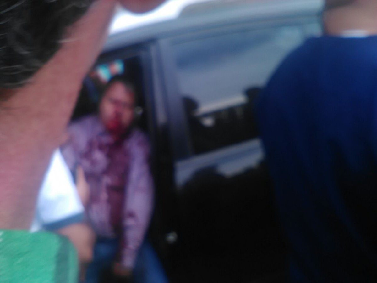 vozdeltolima's tweet photo. #Urgente empresario y una mujer que lo acompañaba en este vehículo fueron baleados. Calle 19 con Cra. 5 #Ibagué. https://t.co/8LeEOpa2Yy