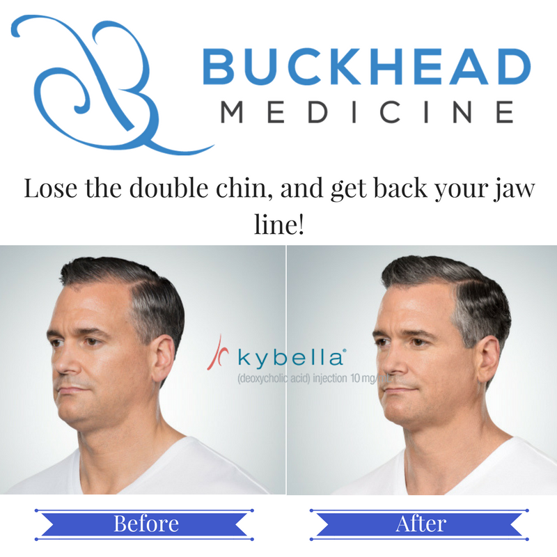 BuckheadMed's tweet photo. Lose your #doublechin permanently with #Kybella! Book your consulation today! https://t.co/kmx8hCyJIt #AtlantaDoctor #Injectables #atl #men https://t.co/LiVPI0lPGi