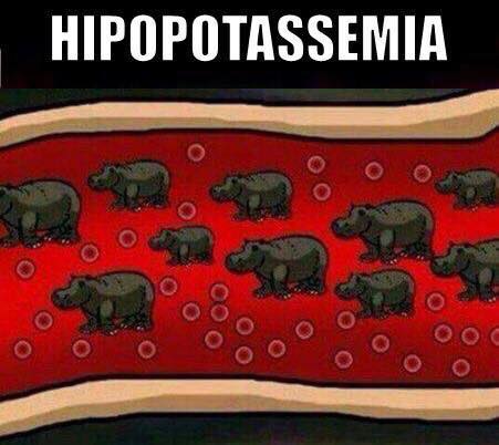 Q: HyperK or hypoK?

H/T facebook.com/anesthesia1/ #FOAMgas #FOAMed