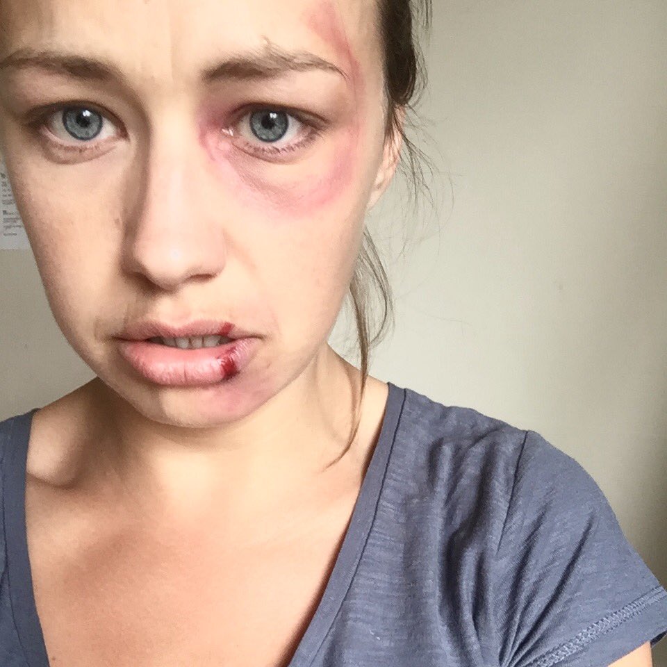 Lorna Dempsey on X: That's a wrap folks!! 🎬no more beatings from this  talented guy 😂@Peter_Alberti #shortfilm #ActorsLife #London #grateful  t.coY1nYAlJaF2  X