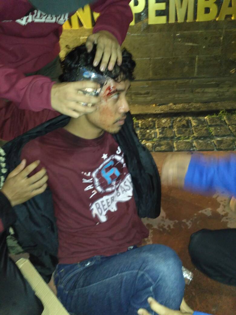 Aksi damai KAMMI dwarnai tindak kotor Polri #KAMMILawanTiraniHukum 
Pdhl tuntun KAMMI pasti, tpi Polri tk kooperatif #KAMMILawanTiraniHukum