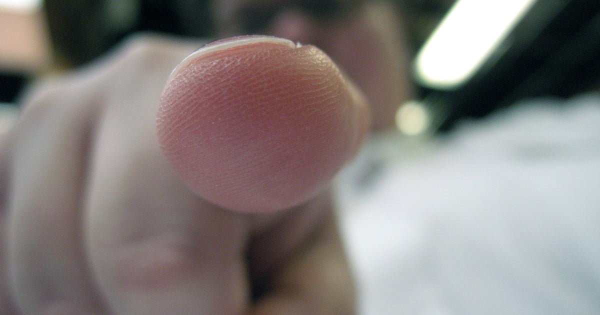 theo_logos77's tweet photo. No cuffs necessary! This sensor can read blood… https://t.co/xIcZi5zSig #Cool_Tech #blood_pressure #smart_sensors #valencell #digital https://t.co/Xk7i5TRVwj