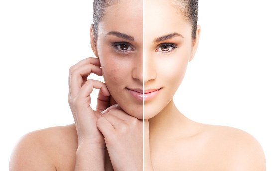 TalentCanvas1's tweet image. indianist.com/how-to-remove-…
#removesuntan #sun #tan #removal #health #articles #skincare #india #summers #healthtips #skintips