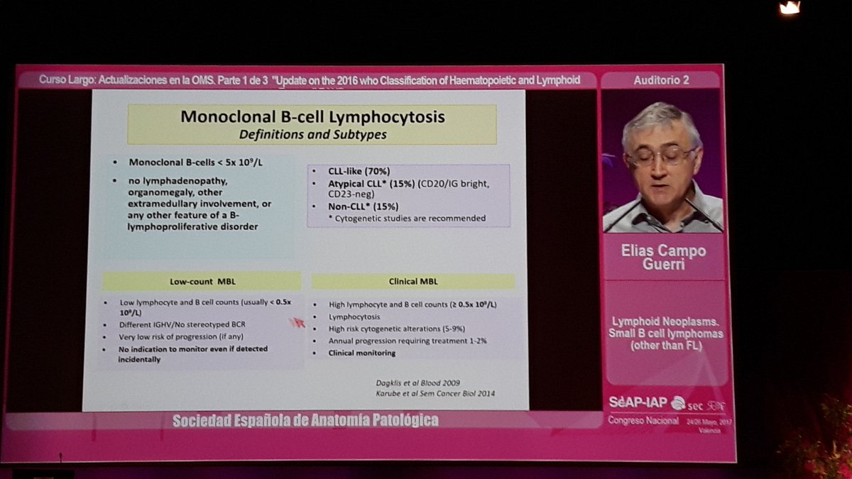 crazylymphocite's tweet image. Other Small B cell lymphomas. Dr. Elias Campo, grate master. #SEAP2017V