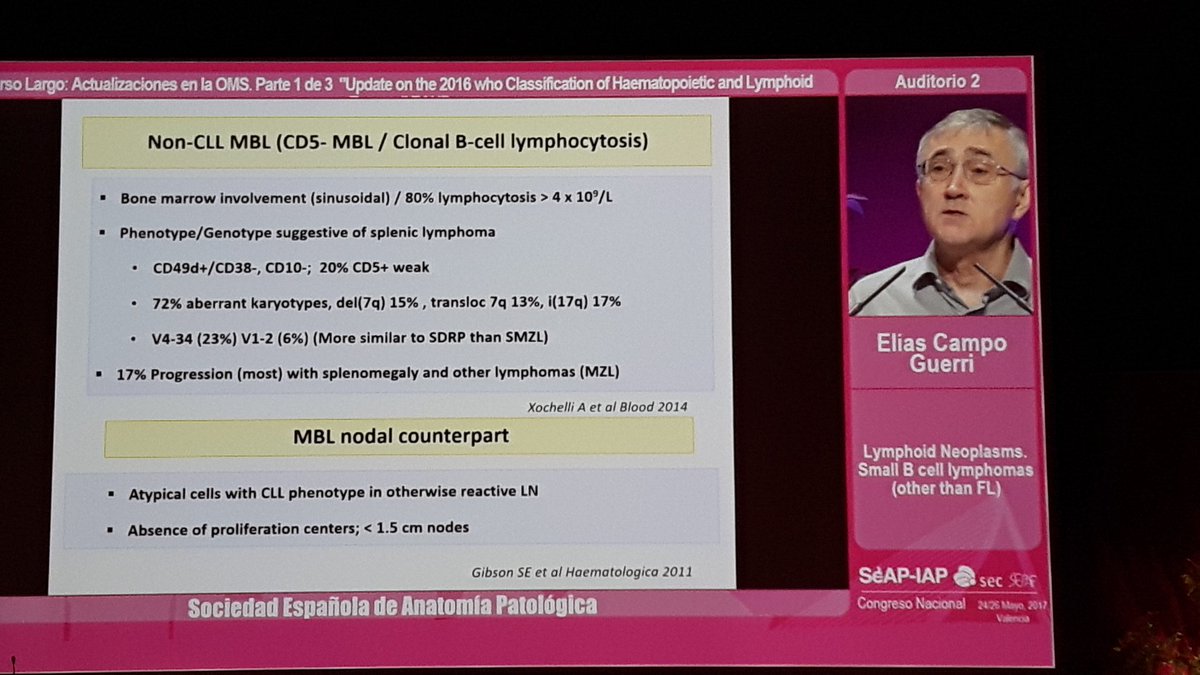 crazylymphocite's tweet image. Other Small B cell lymphomas. Dr. Elias Campo, grate master. #SEAP2017V