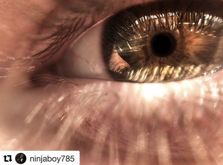 magniband's tweet photo. We always love Magniband eye macros! #Magniband https://t.co/9Dd9czqSR5