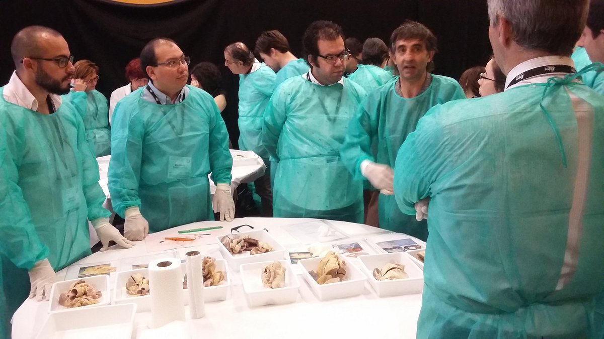 DraEosina's tweet image. La Dra. Sancho ha organizado un taller práctico de disección cardiovascular espectacular. #SEAP2017V #GrossPath #CardiacPath