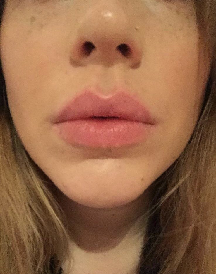 Smidd2's tweet photo. This happens every morning! #BigLipsProblems #Swollen #NoFillers #Natural https://t.co/7yxnbbNsQW