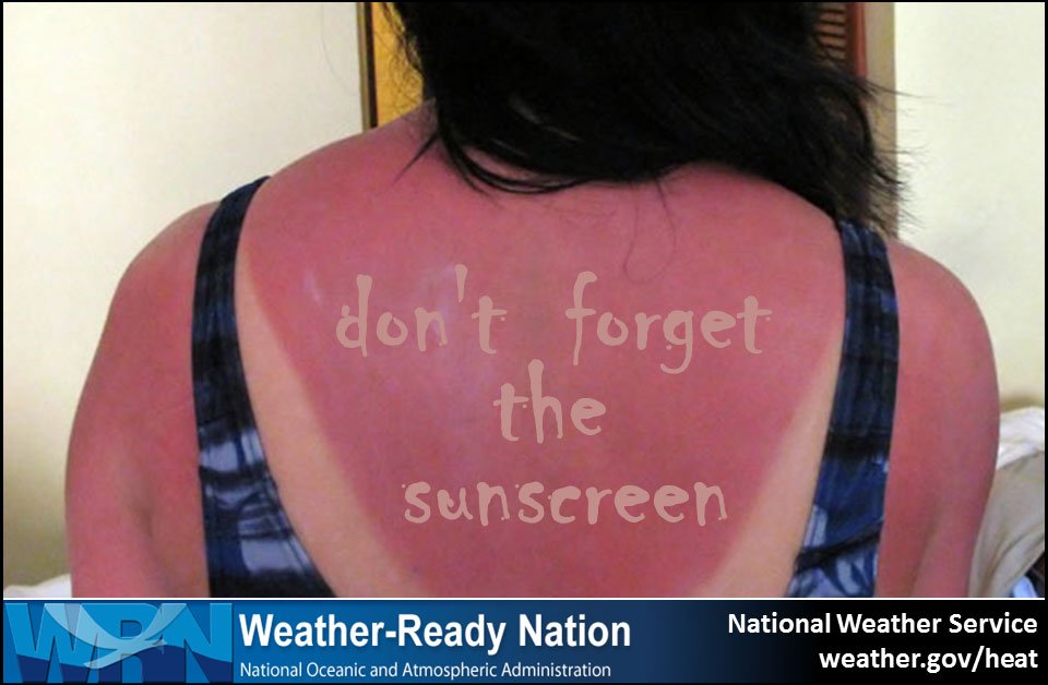 Today is DontFryDay! Don't to wear sunscreen when spending time outdoors! Easier to burn