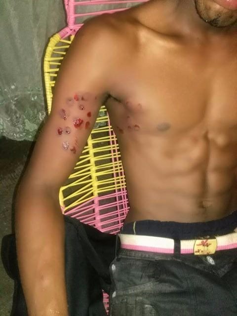 piedadcordoba's tweet photo. #SOSBuenaventura
@mindefensa, ¿Por qué el ESMAD entra a Buenaventura como un ejército de ocupación en la madrugada aterrorizando a la gente? https://t.co/ttdhFVWZdZ