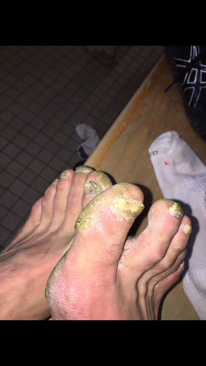 greentoepalacio's tweet photo. Ten Thousand Retweets And I Will Go Graduation With No Shoes On. https://t.co/pdFec8ctnJ