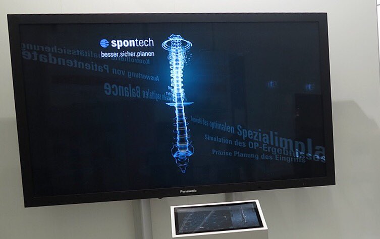 Your TV unlike your spine can be adjusted. Just like  your spine though your TV doesn't get subluxations, osteopathic lesions or  "go out"