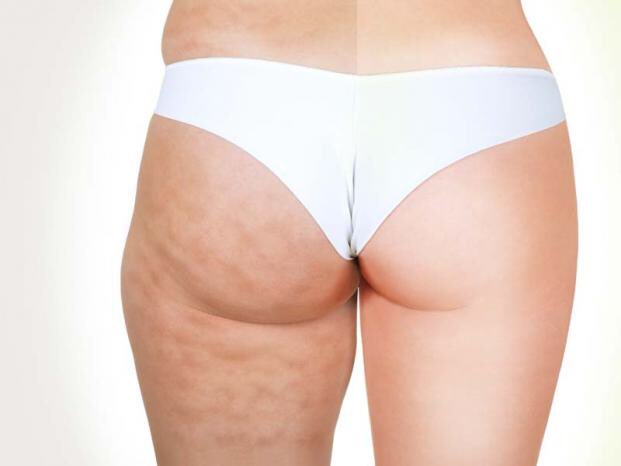 綺麗なボディライン