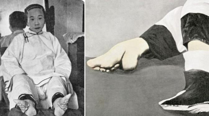 Terungkap, Alasan Tradisi Membonsai Kaki Gadis di Tiongkok dlvr.it/PFdWyb
