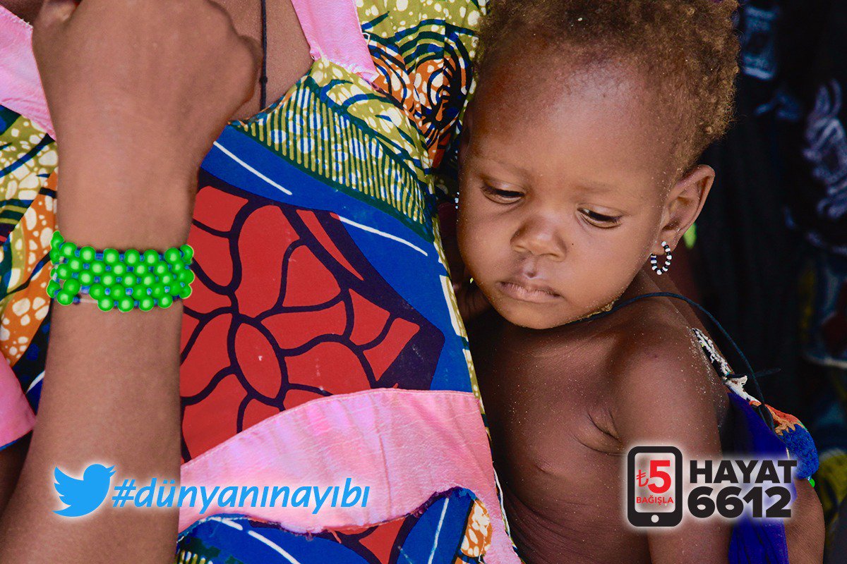 #DÜNYANIN AYIBI: Dünyada 795 milyon insan var her gece aç uyuyan. Onlar için destek zamanı 
HAYAT>6612>5₺