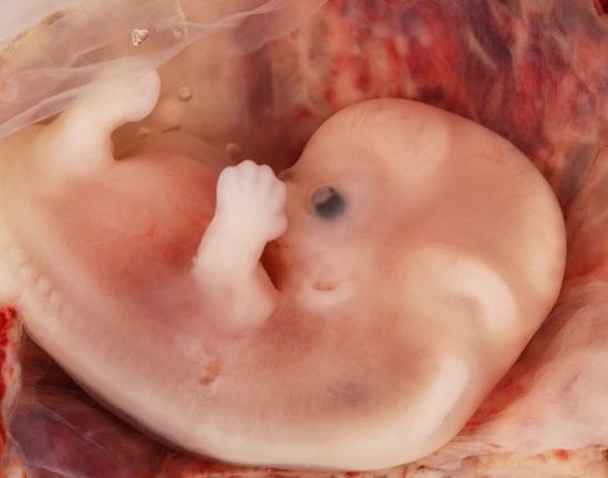 MarcoMariani_IT's tweet photo. Me, when I was very young.
The very first pic.
#instamagic #fetus #youngness https://t.co/F4bGCBPN8Q