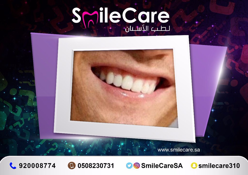le_Abdullah's tweet photo. لمن هذه الابتسامه ؟
الجوائز
1-آيفون 7 
2-قسيمة علاجيه بقيمة 1000 ريال
3-قسيمة علاجية بقيمة 500 ريال
  الشروط: متابعة @SmileCareSA ورتويت https://t.co/1zQrDlEyKw