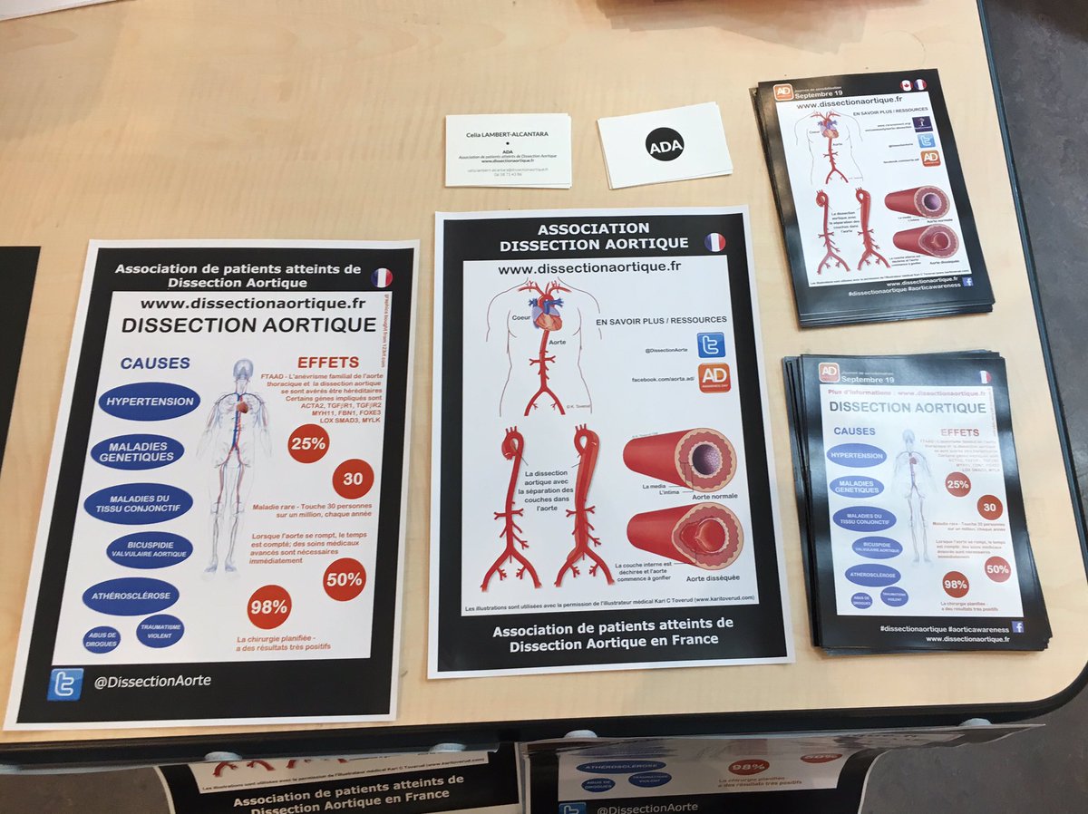 DissectionAorte's tweet photo. Au village technique du Congrès #SFCTCV jusqu'à 13h ! Venez nous rencontrer et consulter nos flyers #dissectionaortique #ada #sfctcv #aorte https://t.co/3l4ky1vvXa