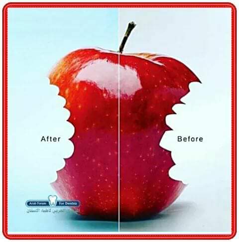 OralPlace's tweet photo. Depois.                             Antes. https://t.co/G95dtuUkTR