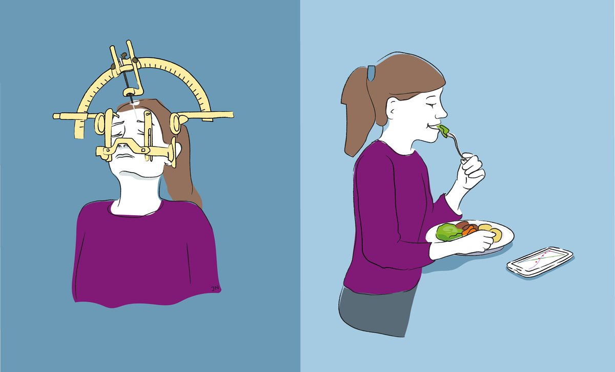 Recovery from anorexia without brain stimulation
mando.se/en/2017/06/09/…
<a href="/TheLancet/">The Lancet</a>
<a href="/JAMAPsych/">JAMA Psychiatry</a> 
<a href="/APAPsychiatric/">American Psychiatric Association</a>
<a href="/nytimes/">The New York Times</a>