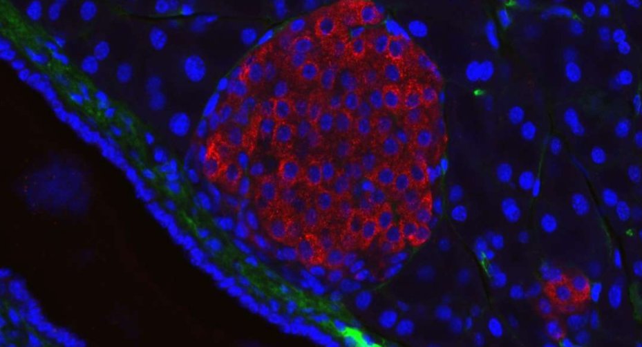 An American research Institute managed to cure a woman's Type 1 Diabetes. #T1D #research iflscience.com/health-and-med… <a href="/IFLScience/">IFLScience</a>