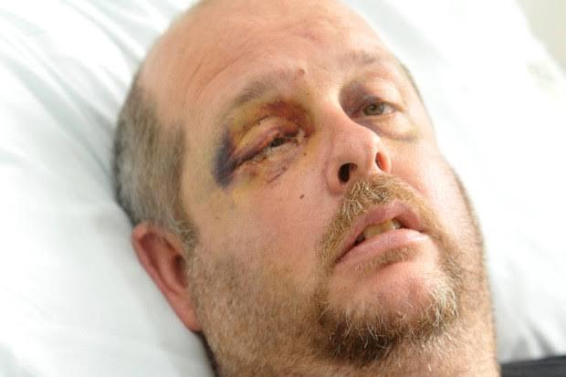 RogerCheetham88's tweet photo. The 4 year journey  since I was attacked in the street and left for dead. #stardust #restorativejustice #victimofcrime #luckytobalive https://t.co/fDzMZNRfhA