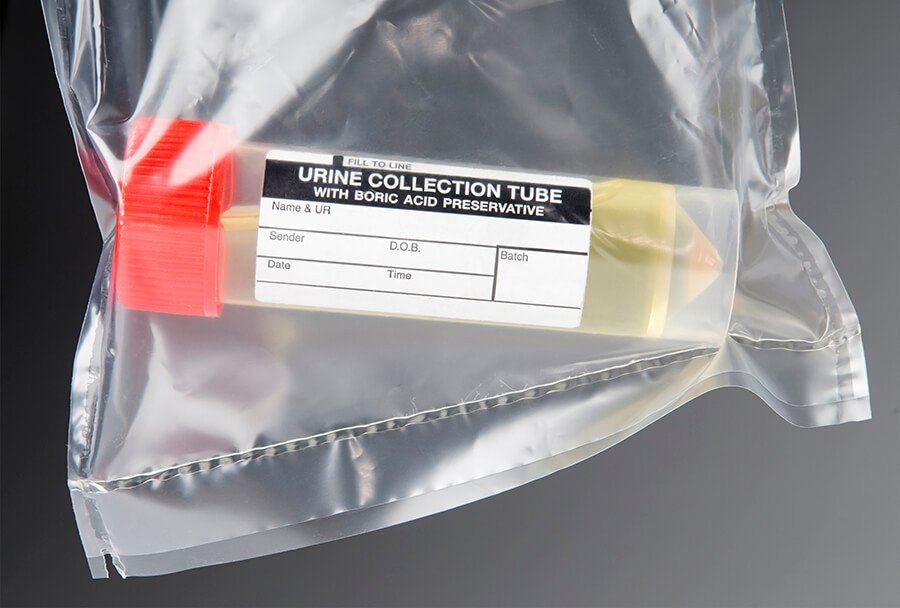 Testing for two biomarkers in urine may help some men avoid an unnecessary biopsy for suspected prostate cancer: cancer.gov/news-events/ca…