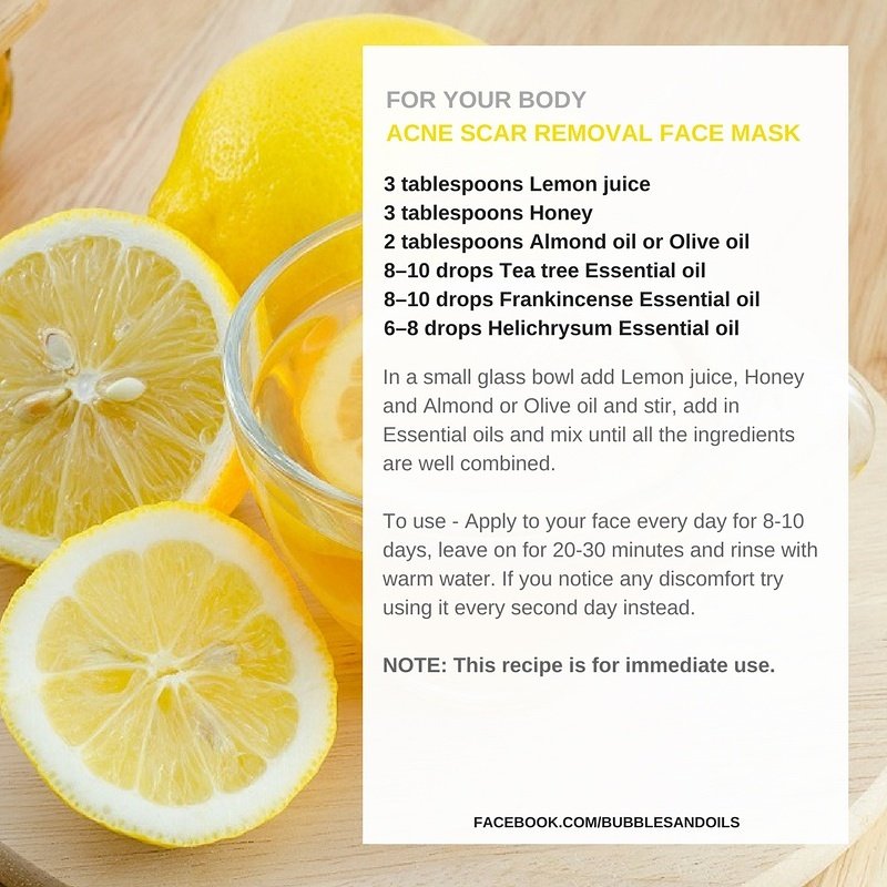 BubblesAndOils's tweet photo. Try this natural #acne scar recipe it will not disappoint! For more info + advice make contact with us :) #beauty #diy #acneproblems #health https://t.co/4Uluk8aD17