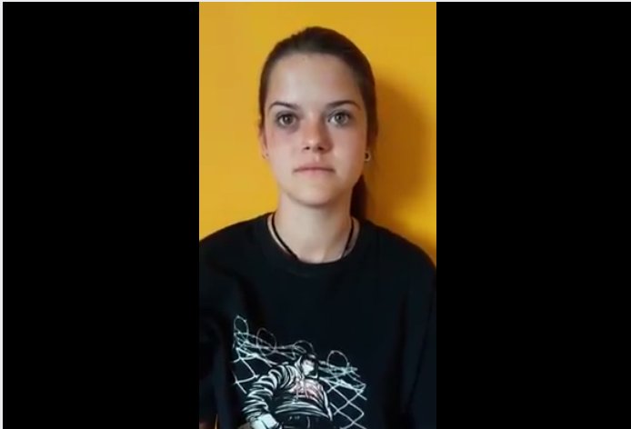 DinamoPress's tweet photo. Succede a #Torino https://t.co/RjOdNEwaTf Maya 19 anni: fermata illegalmente e picchiata dalla #polizia. Basta violenza sulle donne #acab https://t.co/pN4NdPr5bC