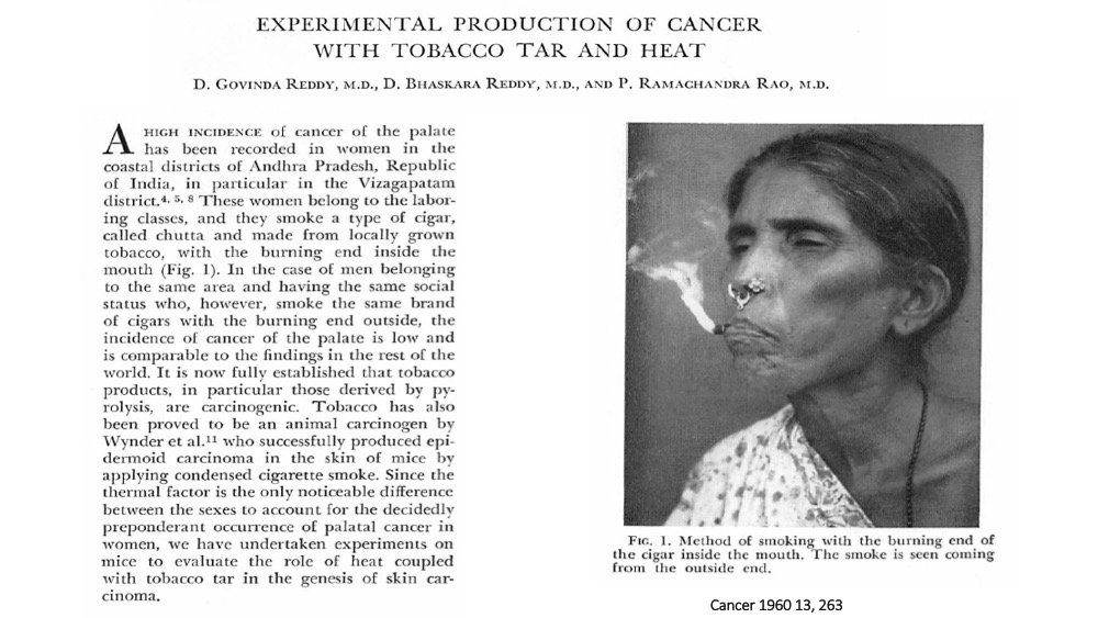 cllaboisse's tweet photo. A case of glowing #carcinogenesis #palatal #cancer #tar #tobacco https://t.co/3enNwdUhNS