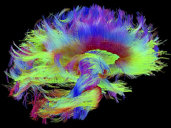 Cynthiapoet's tweet image. From Macro to Micro: A Visual Guide to the #Brain bit.ly/2rq59ri