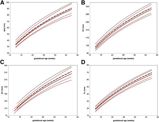 AJOG_thegray's tweet photo. Development of customized #fetal growth charts in #twins  - https://t.co/bxCUj19t6p https://t.co/4FNMvHFFfe
