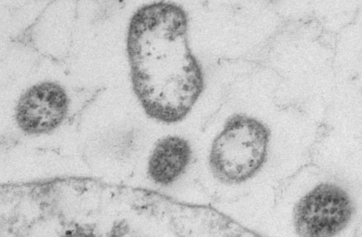 ComDigitalUPA's tweet image. Virus artificiales que ayudan a curar el cáncer bit.ly/2rOr2Au