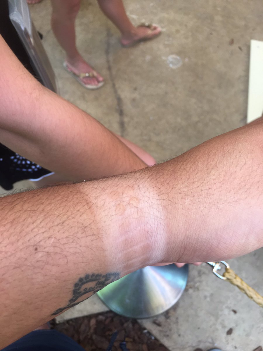 MelvinG16's tweet photo. You know you went to volcano bay when #volcanobay #imnotcomingback #allridesbroken #dontcomeandwastemoney @VolcanoBay https://t.co/bjvULM6adN